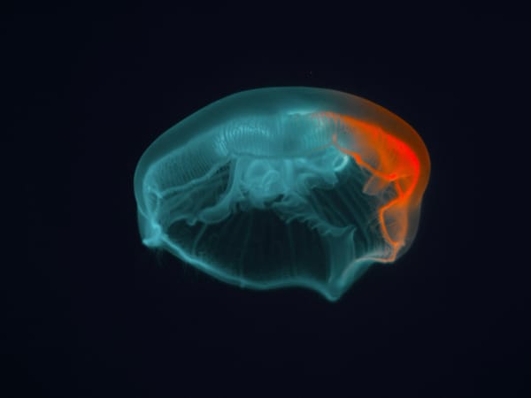 An MRI scan of brain